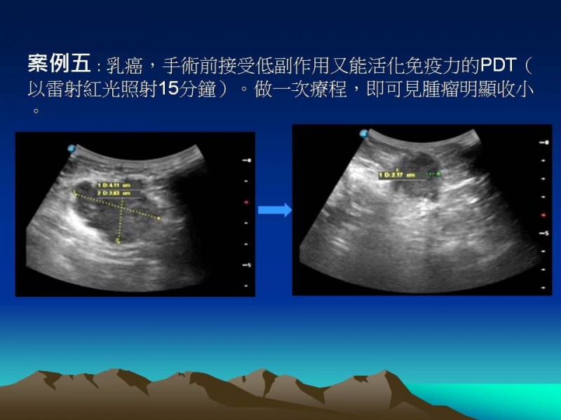 投影片24