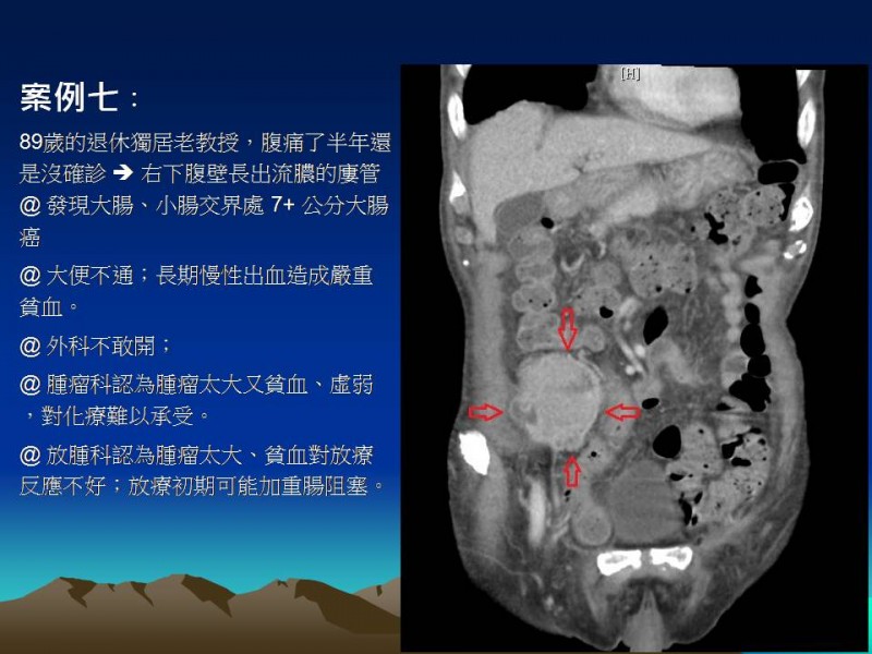 投影片26